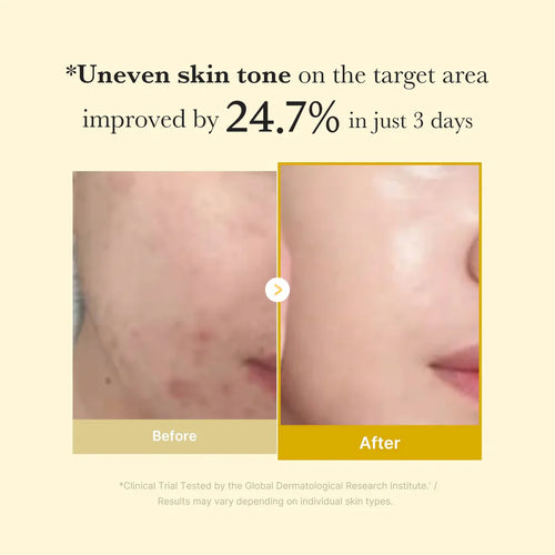 kojic acid turmeric night mask